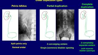 Intravenous Urography basics [upl. by Shear933]