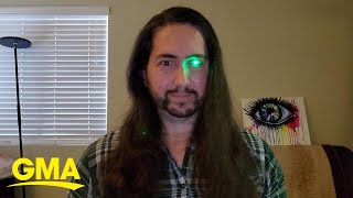 Man loses eye to cancer turns prosthetic eye into flashlight l GMA [upl. by Anidem861]