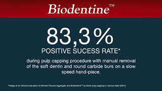 Biodentine in Atraumatic Restorative Treatment ART [upl. by Essilrahc360]