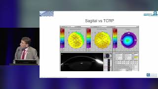 Pentacam® AXL – Clinical Results [upl. by Asserac358]