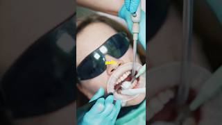 “Laser DentistryThe Future Of Root Canal “ [upl. by Niela356]