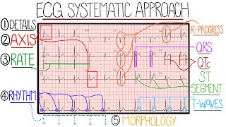 ECG Interpretation Made Easy Learn How to Interpret an ECG in 13 Minutes [upl. by Anemij]