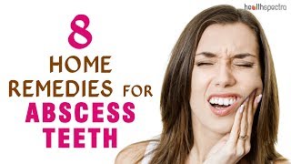 8 Home Remedies for Abscess Teeth [upl. by Harvard]