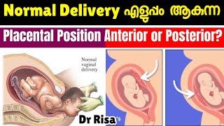 പ്രസവം എളുപ്പമാകുന്ന Placental Position  Anterior amp Posterior Placenta [upl. by Rafaelia]