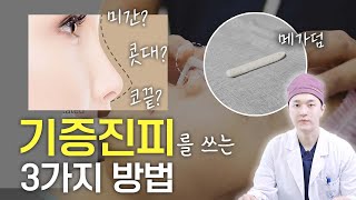 기증진피로 콧대코끝미간 전부 다 높일 수 있다고 메가덤 활용법 by 성형외과 전문의 [upl. by Meras]