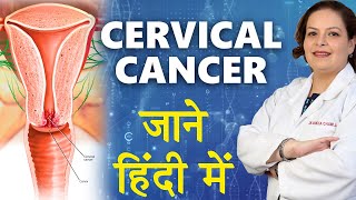 Cervical Cancer In Hindi  गर्भाशय कैंसर जाने हिंदी में  Dr Shikha Chawla [upl. by Ahsimak667]