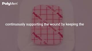 Wound Healing Journey with PolyMem Dressings  Part 2 Proliferative Phase [upl. by Sadiras]