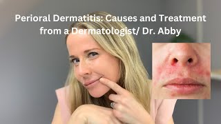 Perioral dermatitis causes and treatment from a Dermatologist [upl. by Notnilk]