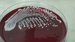 Staphylococcus hominis colony morphology on blood agar of blood culture [upl. by Ettenirt]