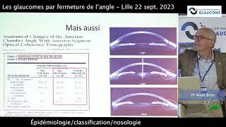 Épidémiologie classification nosologie Pr Alain Bron [upl. by Lenes]