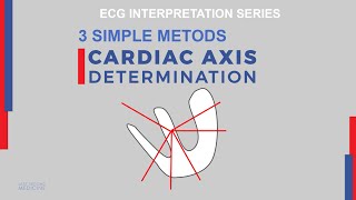 Understand Cardiac Axis amp How To Calculate on ECG  Background 3 Methods Causes of Axis Deviation [upl. by Azpurua]