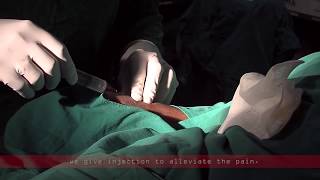 Coronary angiogram  a live demonstration [upl. by Gaillard]