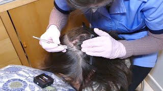 ASMR School Nurse LICE Check and Removal with Tweezers Real Person [upl. by Ahseirej6]