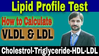 Lipid Profile Test CholestrolTriglycerideHDLLDL [upl. by Selec]