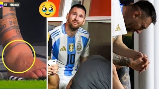 Messi Ankle Injury😱 painful🥹 [upl. by Swane]