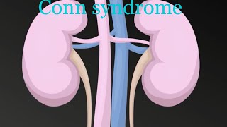 how to diagnose conns syndrome [upl. by Aerdnat293]