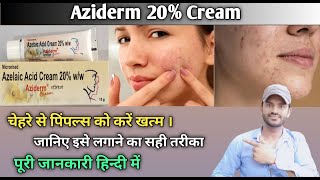 Aziderm 20 cream use benefits and side effects full review in hindi [upl. by Bortz]