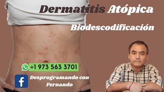 ¿Por qué sufro de DERMATITIS ATOPICA BIODESCODIFICACIÓN [upl. by Tigges]