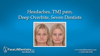 Headaches TMJ pain Deep Overbite Seven Dentists [upl. by Euphemia]