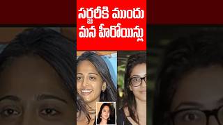 Heroines Before and After Surgery  Tollywood Actresses  Tollywood Nagaram [upl. by Ainar]