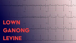 Lown Ganong Levine  ECG EKG Interpretation [upl. by Nason]