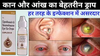 ciplox d eye ear drops  ciprofloxacin dexamethasone eye ear drops ciplox d uses in hindi [upl. by Dorree179]