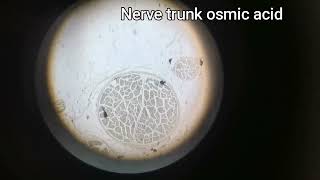 Nerve trunk osmic acid [upl. by Raquela]