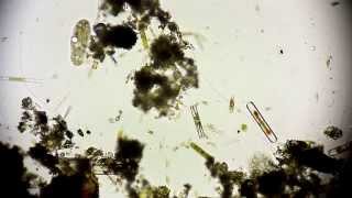 Euplotes  Protist  Ciliate  Wimpertierchen  microorganisms under microscope [upl. by Holihs]