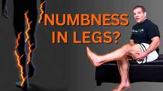 Numbness in Legs Causes and Treatment [upl. by Nyladnohr]