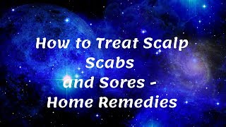 How To Treat Scalp Scabs and Sores  Home Remedies [upl. by Nnyltiak]