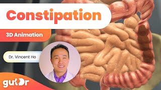 Constipation  The GutDr Explains 3D Gut Animation [upl. by Tammi]