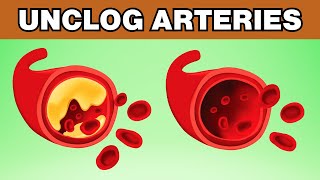 7 Proven Foods to Unclog Arteries Naturally [upl. by Ffoeg]