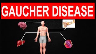 Gaucher Disease [upl. by Caprice]