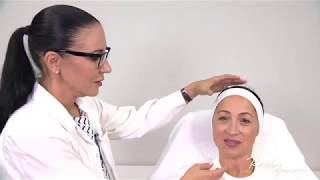 Restylane Skinboosters Signature Techniques Treating cheek lines by Dr Marina Landau [upl. by Aenet]