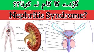 Nephrotic syndrome नेफ्रोटिक सिंड्रोम  Causes Symptoms Treatment in HindiUrdu [upl. by Redyr]