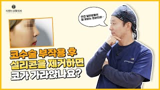 코성형 실리콘 제거 후 정말 코가 가라앉을까요 [upl. by Llenrac]