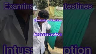 Diagnosis of Intussusception l dr Umar khan [upl. by Danialah]