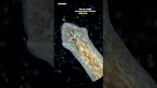 Freshwater Flatworm Under Microscope Planarian [upl. by Nywles281]