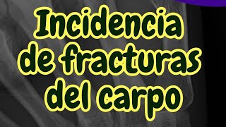 ¿Cuál es el hueso que más se fractura del carpo [upl. by Ydnam]