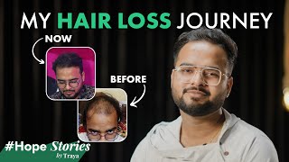 quotI Stopped My Genetic Hair Loss with This Productquot  Yasin Shares His Emotional Story HopeStories [upl. by Stig]