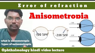 anisometropia  error of refraction  what is anisometropia  anisometropia  optometryhindi [upl. by Ellery1]