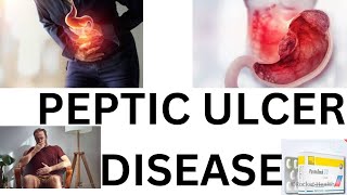 Peptic ulcer diseaseAmharic tutorial [upl. by Netniuq]