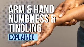 Arm and Hand Numbness and Tingling Explained [upl. by Melesa547]