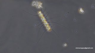 Chaetoceros diatomeas  diatoms [upl. by Hummel]