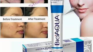 BioAqua Anti Acne Cream [upl. by Noerb]