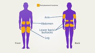 Omnipod® 5 Automated Insulin Delivery System Product Training  Pod Activation [upl. by Haswell330]