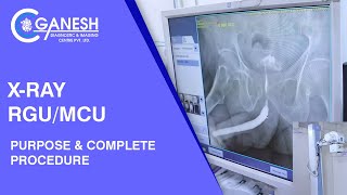 XRay RGUMCU Test Purpose amp Complete Procedure at Ganesh Diagnostic [upl. by Agn]