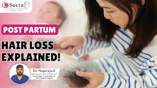 New Mom Dealing with Hair Loss WATCH THIS  Sweta Clinics [upl. by Byrdie]