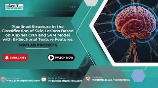 Pipelined Structure in the Classification of Skin Lesions Based on Alexnet CNN and SVM Model with Bi [upl. by Oirom40]