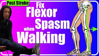 Fix a spastic Leg Post Stroke [upl. by Joseph]